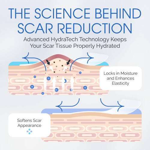 Scarscience Medische Silicone Littekens Sheets - Groot 7" Waterdicht, Herbruikbare Silicone Littekens Strips 2