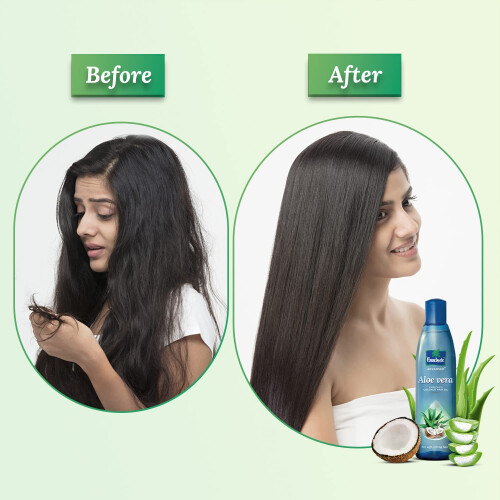 Parachute Advansed Έλαιο Καρύδας με Αλόη | Για Δυνατά, Μαλακά & Μεταξένια Μαλλιά | 5.1 Fl.oz. 1