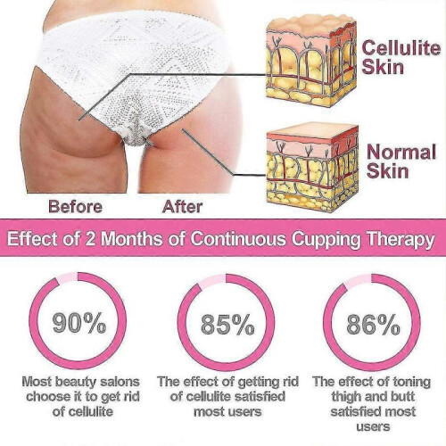 4pcs Silicone Vacuum Cup, Cupping Therapy Set 2