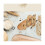 Fermentat Basket,2 Linen Inserts, Fermentat Basket Set,less Easy To Clean Ferment 13