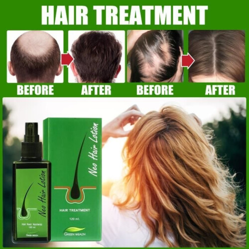 Neo Hair Lotion (1 τεμάχιο) – Λοσιόν κατά της τριχόπτωσης, ορός essence, λάδι, θεραπεία ανά 1