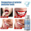 (30ml Box) Temporary Tooth Repair Teeth Gaps False Teeth Solid Glue Denture Adhesive 2