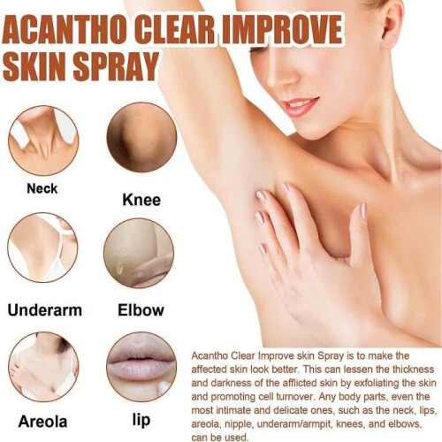 Acantho Clear Therapeutic Spray, Θεραπευτικό Σπρέι για τη Μαύρη Ακάνθωση, Acantho Clear Spray 2