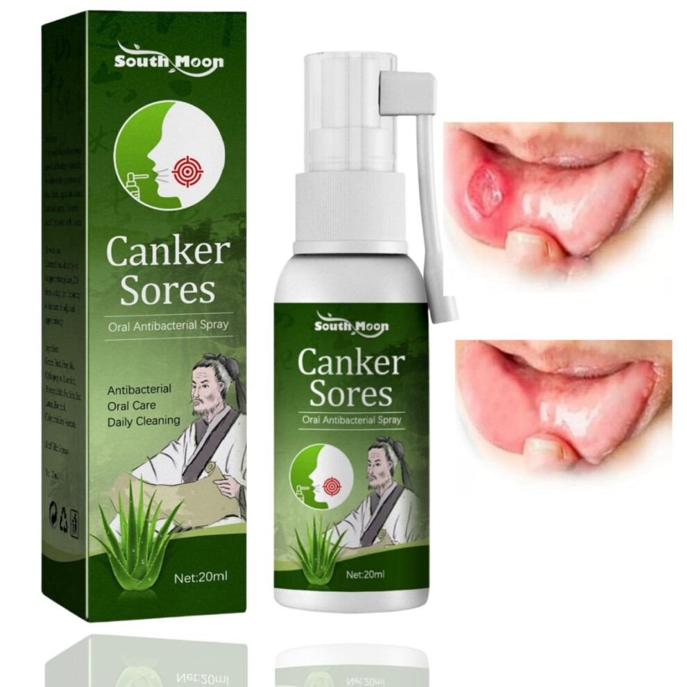 South Moon Canker Sores Antibacterial Oral Care Daily Cleaning 20Ml