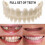 False Teeth Upper Lower Dental Veneers Dentures Tooth Cover Set [free Shipping]-hy 1