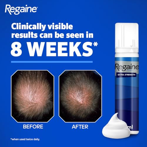 Regaine Regaine Foam For Men - 3 month supply - 3 x 73ml 2