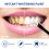 Teeth Whitening Gel Extra Strong White Tooth 3