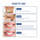 Teeth Whitening Gel Extra Strong White Tooth 9