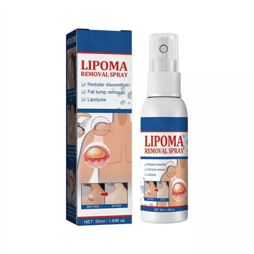 3X Lipomheilung Reduction Spray, Lipoma Removal