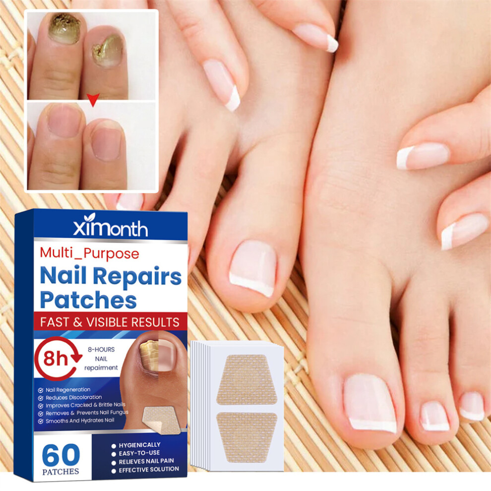 300pcs Nail Repair Patch Hand And Foot Soft-image-OPC-PHYMZWG-NEW