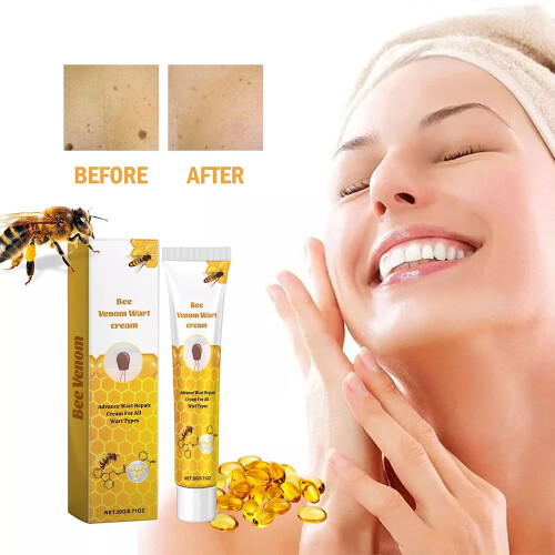 Bee Venom Wart Remover Cream for All Skin Types 2