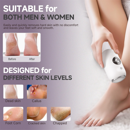 Electric Foot Callus Remover Fully Automatic Foot Grinding Device 1