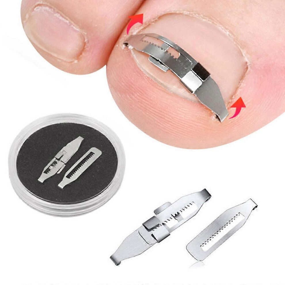 (2 x ingrown toenail buckle, One size) Carbon steel Ingrown Toenail Pedicure Tool Straightening Correction Clip Curved Brace Toenails Thick Paronychia