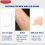 Elastoplast Elastoplast Scar Reducer 7 Patches Reduction Skin Keloid Raised 4