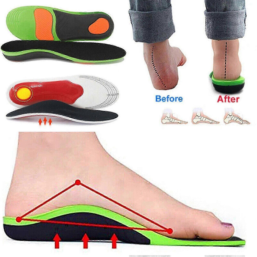 Kikidex (45To47, One Size) Orthopedic Insoles Insert Arch Support Flatfoot Heel Pain Plantar Fasciitis