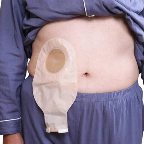 50 peças de bolsas de ostomia drenáveis para colostomia e ileostomia 1