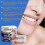 Silicone Relinedenture Set, Denture Reline Kit, Denture Set 5