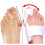 2pcs Orthopedic Bunion Corrector, Bunion Splint, Foot Pain Relief Hallux Toe Valgus Corrector Adjustable 1