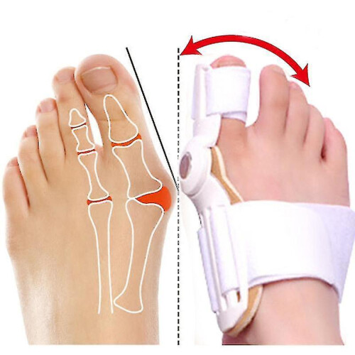 2pcs Orthopedic Bunion Corrector, Bunion Splint, Foot Pain Relief Hallux Toe Valgus Corrector Adjustable