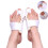 2pcs Orthopedic Bunion Corrector, Bunion Splint, Foot Pain Relief Hallux Toe Valgus Corrector Adjustable 3