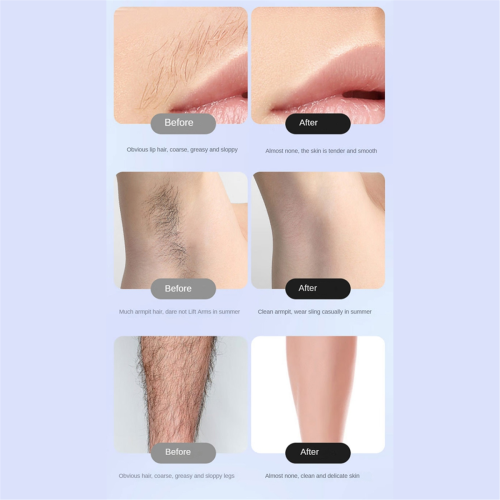 2in1 Elektrischer Bikini-Trimmer für Damen, Nass-/ 2