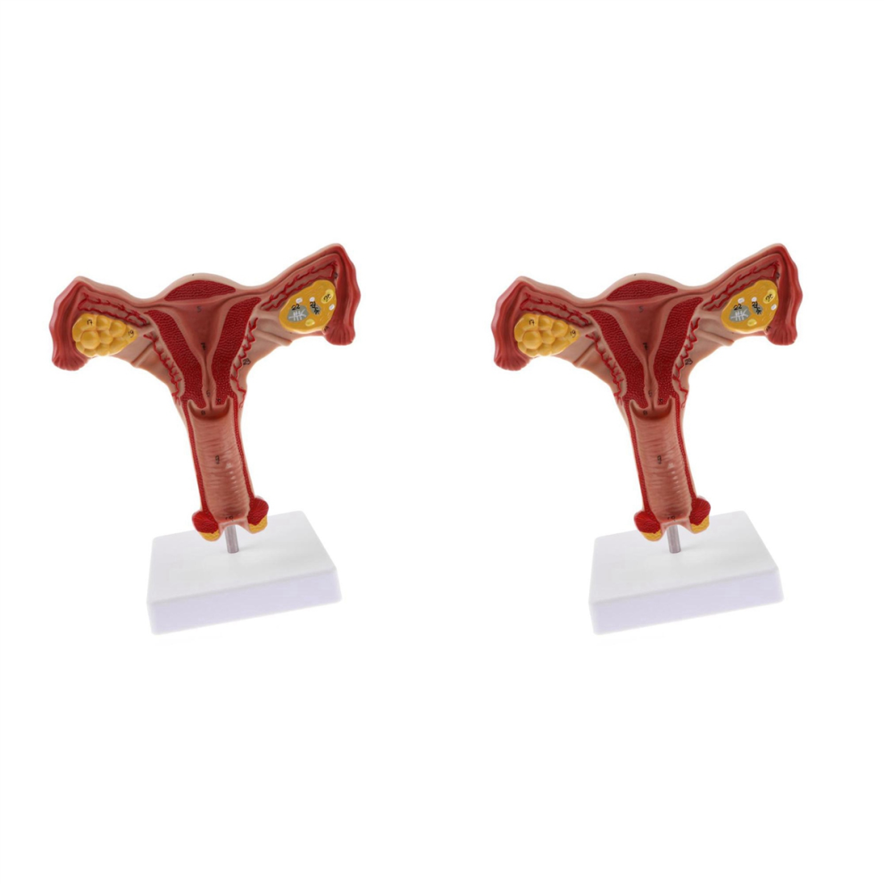 1:1 Menschliche Weibliche GebäRmutter Eierstock Eileiter Modell Lehrmittel-image