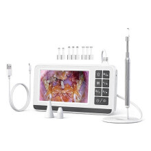 Digital Visible Light Ear Spoon, Otoscope Ear Camera