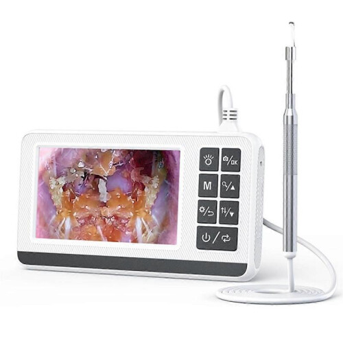 Digital Visible Light Ear Spoon, Otoscope Ear Camera 2