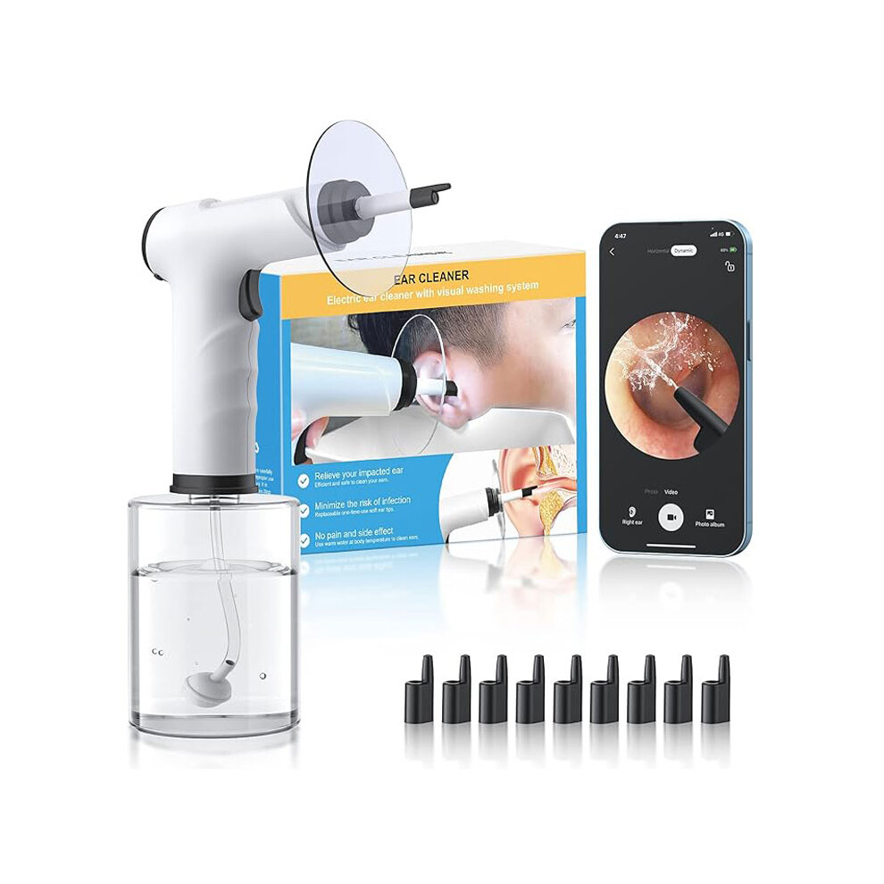 Visual Electric Ear Wax Removal Kit