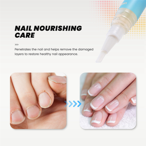 Nagelpflegeöl-Stift, Nagelpilzbehandlungsstift 2