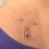 12Pcs Copper Skin Tag Remover Clips Wart Tag Extractor Copper Tag Out 3