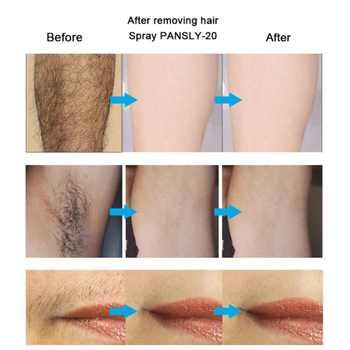 Hair Growth Inhibitor Removal Cream Beard 50Ml 1