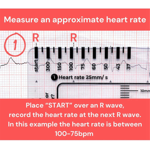 7-Step Ruler Rapid and Rapid Heart Analysis and Measurement Tool 2