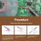 6PCS Desoldering Braid Welding Solder Remover Tool 4