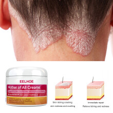 2X Skin Psoriasis Cream Dermatitis Eczematoid.