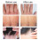 2X Skin Psoriasis Cream Dermatitis Eczematoid. 7