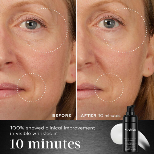 Medik8 Medik8 Liquid Peptides Advanced MP - With Breakthrough Bio-Technology, Dual MiniProteins - 30% Multi-Peptide Complex - 30ml 1