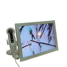 2023 HD Digitale Huid- en Hoofdhuidanalysator - Professioneel Haarfollikel-, Olie- en Vochtigheidstestapparaat met 15-inch scherm