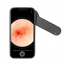 iboolo DE 3100 Pro Dermascope: Gepolariseerde Dermatoscoop en UV Woods Lamp voor Geavanceerde Huiddiagnose