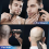 Foil Shaver,Shaver for Men with Ultra-Thin Meshes, 10