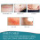 Feuilles de Silicone Médical pour Cicatrices, Ruban de Silicone (1,6" x 60") 4