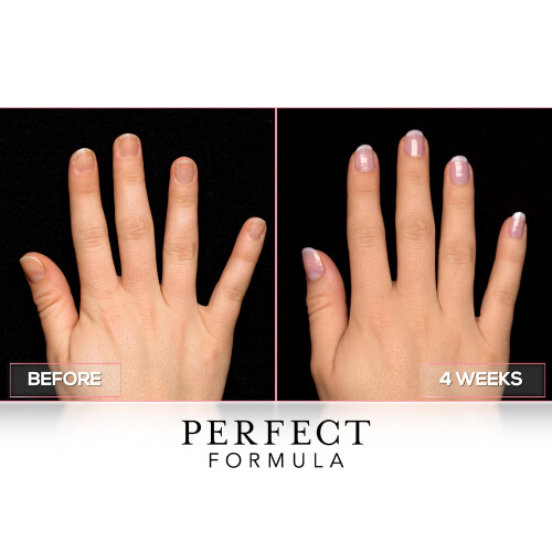 Perfect Formula Clear Gel Coat - Ενισχυτής Νυχιών, Θεραπεία Κερατίνης, Διαφανές Βερνίκι 2