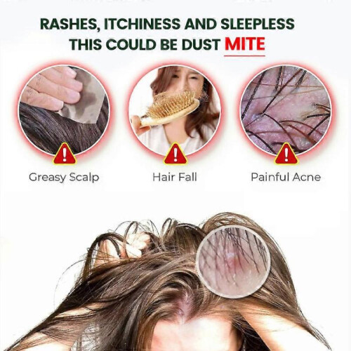 Mite Removal Anti-itching Scabies Kill Lice Skin Care 2