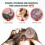New Mite Removal Anti-itching Scabies Kill Lice Skin Care 5