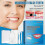 Moldable Tooth Filling False Teeth Temporary Repair Kit Solid Glue Denture 8