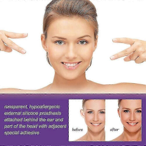 Ear Corrector, Ear Corrector Tape Solve Big Ear Problem, Protruding Ear Solution Ear Correctors Stickers Waterproof for Adults 1