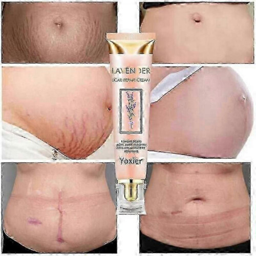 1Pc Lavender Scars Repair Cream Effective Acnes Scars Removal Gel 2