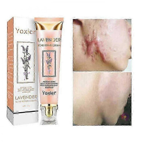 1Pc Lavender Scars Repair Cream Effective Acnes Scars Removal Gel 1