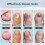 Nail-Fungus Lasers Device, Device for Multiple Toenails Fingernails, Effectively Addressing Weak Damage Nails for Home Use 5