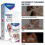 (2pcs) 1-3X 2025 Tinnitus Spray Ear Ringing Relief Relieving Ear Drops Hearing 30ml 5